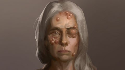 Contagion Wing